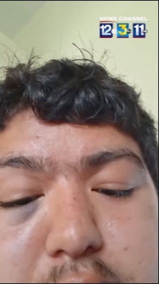 Erick Z.: U.S. citizen special education student detained, wrist broken by ICE